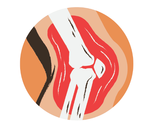 Joint Genesis for joint Pain Relief